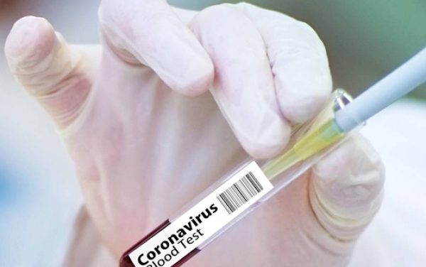 Gabon/Covid-19: Des nouvelles mesures pour freiner la propagation du virus
