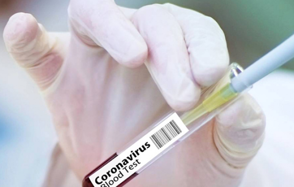 Gabon/Covid-19: Des nouvelles mesures pour freiner la propagation du virus