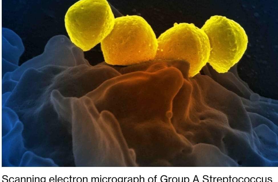 🛑Alerte au Japon : Propagation rapide d’une bactérie « mangeuse de chair » potentiellement mortelle